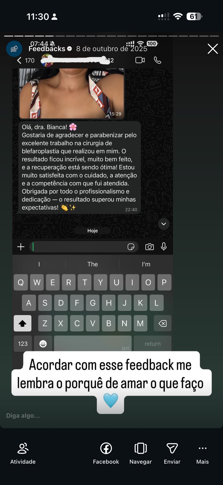 Feedback de blefaroplastia Dra. Bianca Barreto